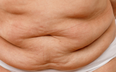 Debunking the Myth: Does Fat Make You Fat?