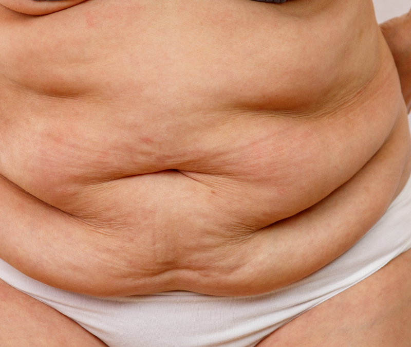 Debunking the Myth: Does Fat Make You Fat?